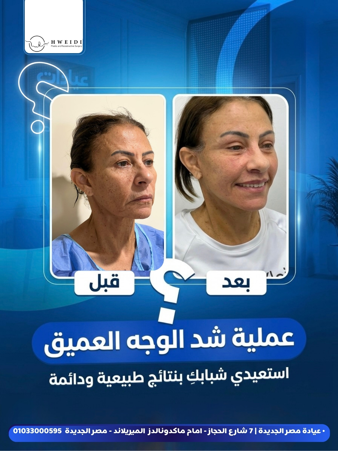 شد عميق للوجه والرقبة