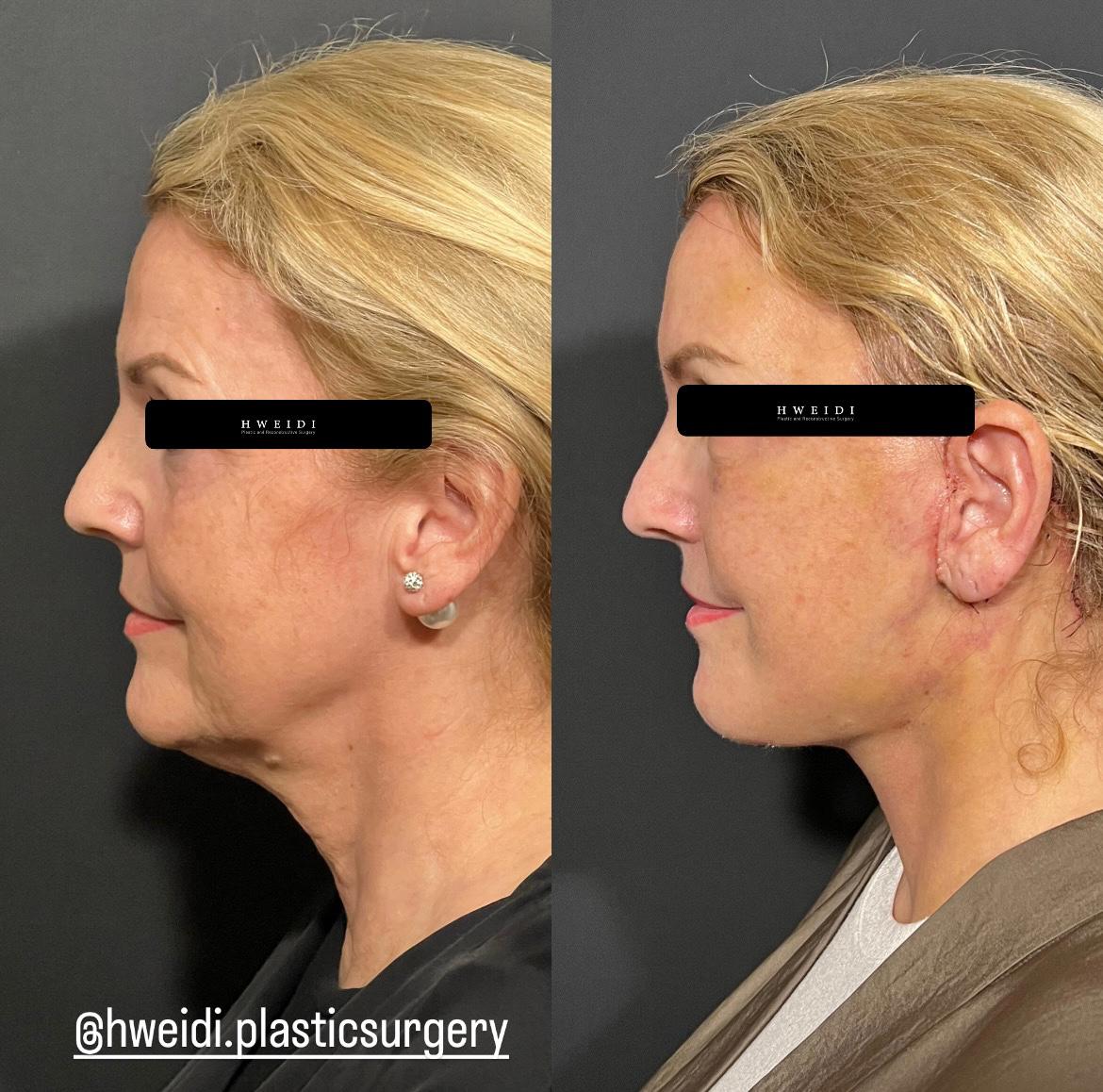 صورة 3