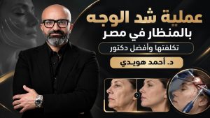 عملية شد الوجه بالمنظار